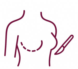 Cirurgia Mamária - Mastologista Campinas