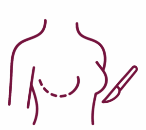 Cirurgia Mamária - Mastologista Campinas